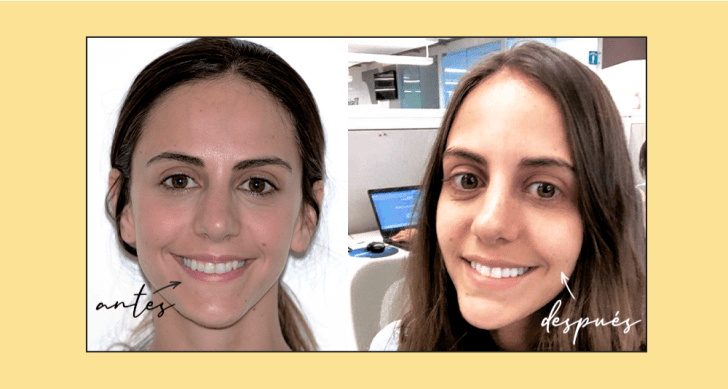 Mariana Sabau es una de nuestras pacientes graduadas de moons y miembro de nuestro muro de la fama. En este post podrás ver cómo fue su experiencia usando los alineadores invisibles moons.
